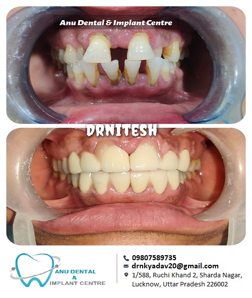 ANU DENTAL & IMPLANT CENTRE Medical Services | Dentists