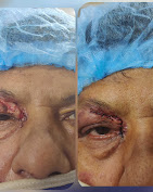 Avantika eye care and glaucoma services Medical Services | Hospitals