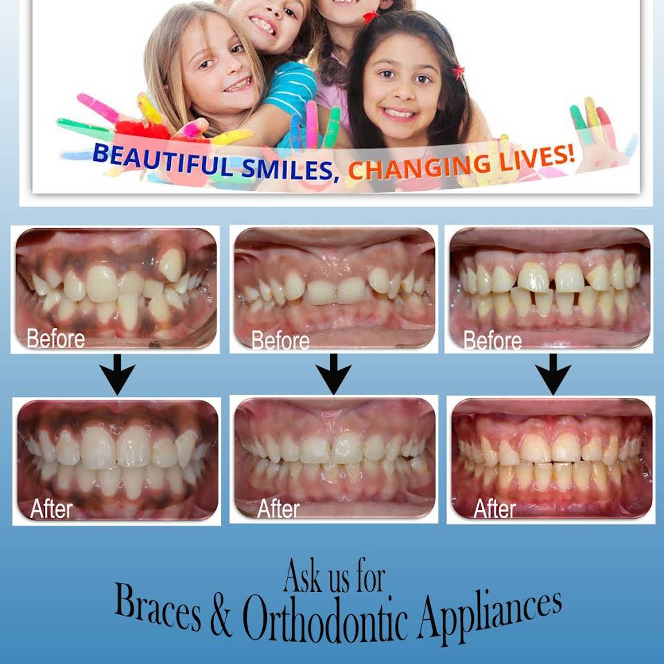 Braces n Smiles Dental Clinic|Clinics|Medical Services