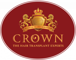 Crown Hair Transplant Experts | Hair Transplant Clinic In Delhi | FUT & FUE Hair Transplant | Hair Transplant In Delhi, NCR|Healthcare|Medical Services