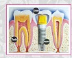 Dental Implant Laser Cosmetic Centre Logo