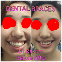 Dr Phukans Dental braces and Orthodontic Clinic Medical Services | Dentists