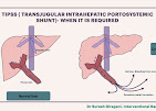 DR. Suresh Giragani | Interventional Radiologist in Hyderabad Medical Services | Hospitals