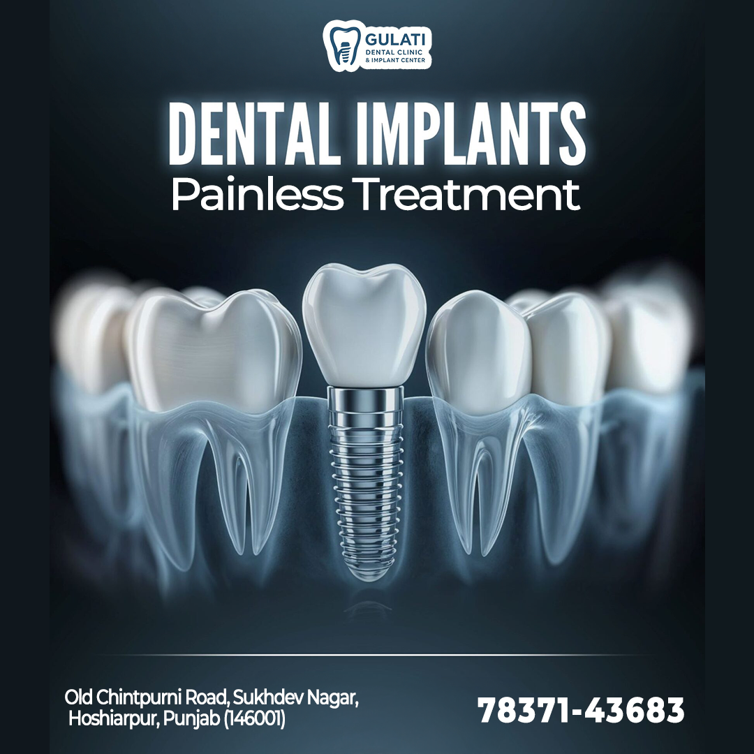 Gulati Dental Clinic & Implant Centre Medical Services | Dentists