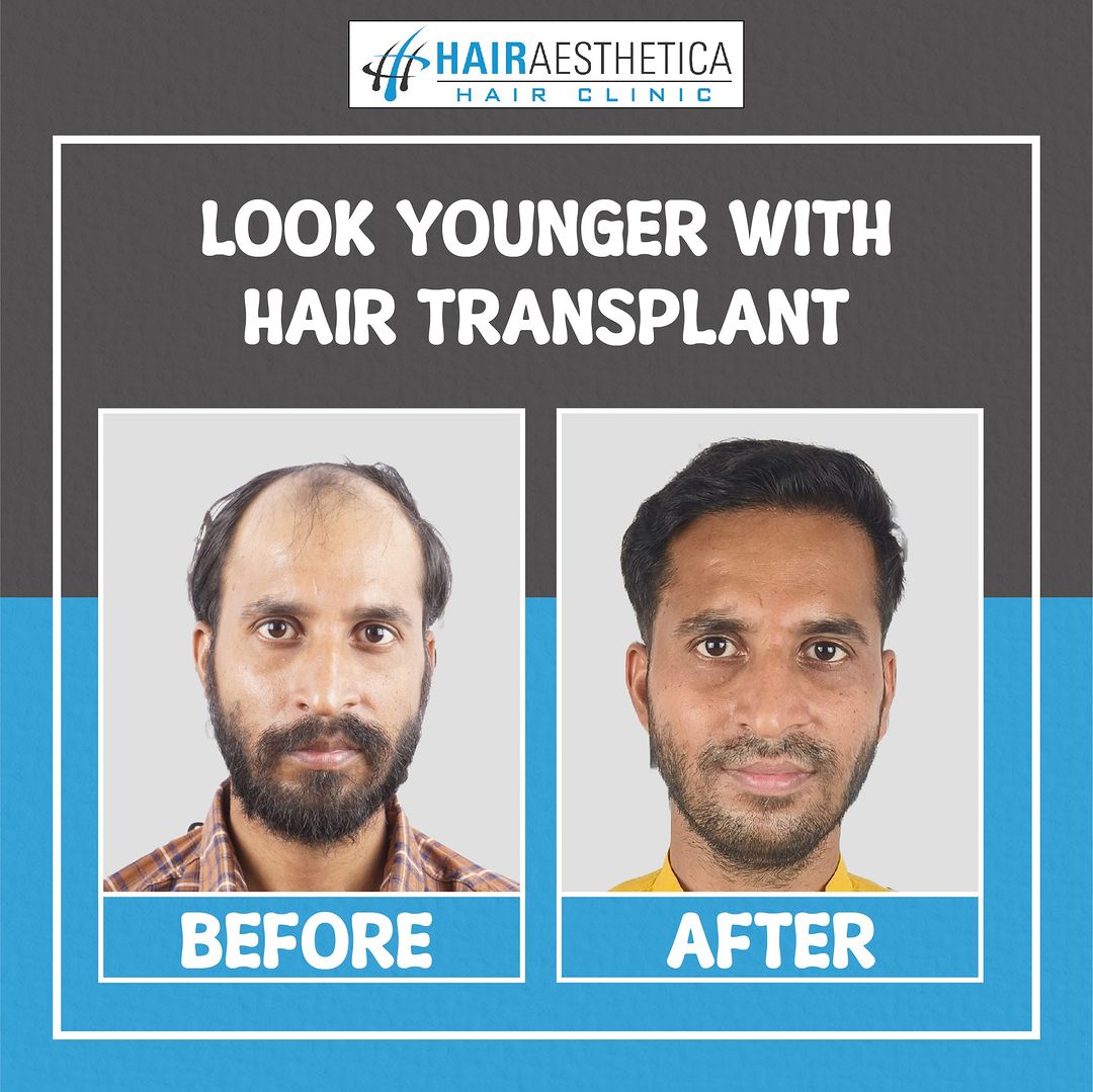 HAIR AESTHETICA Hair Clinic Medical Services | Healthcare