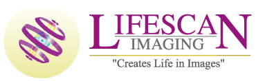 LifeScan Diagnostic Centre Logo