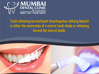 Mumbai Dental Clinic Logo