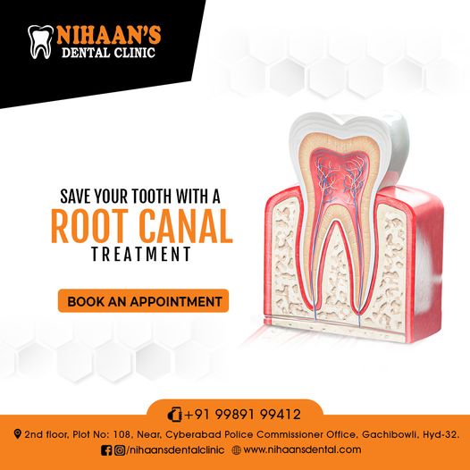 Nihaans Dental Clinic Medical Services | Dentists