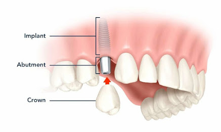 Sandhu Dental Multispeciality Clinic Medical Services | Dentists