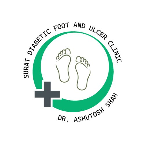 Surat Diabetic Foot and Ulcer Clinic|Clinics|Medical Services