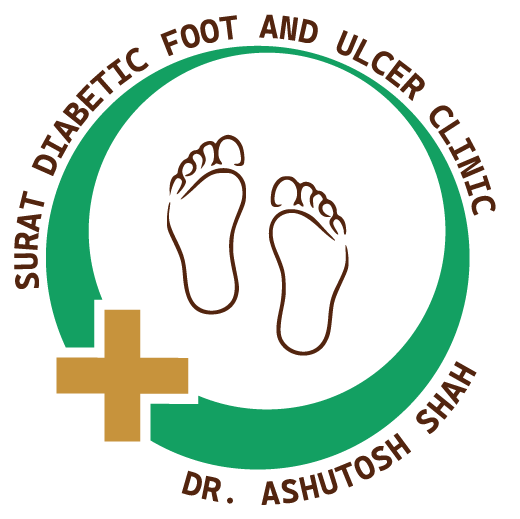Surat Diabetic Foot and Ulcers Clinic|Clinics|Medical Services