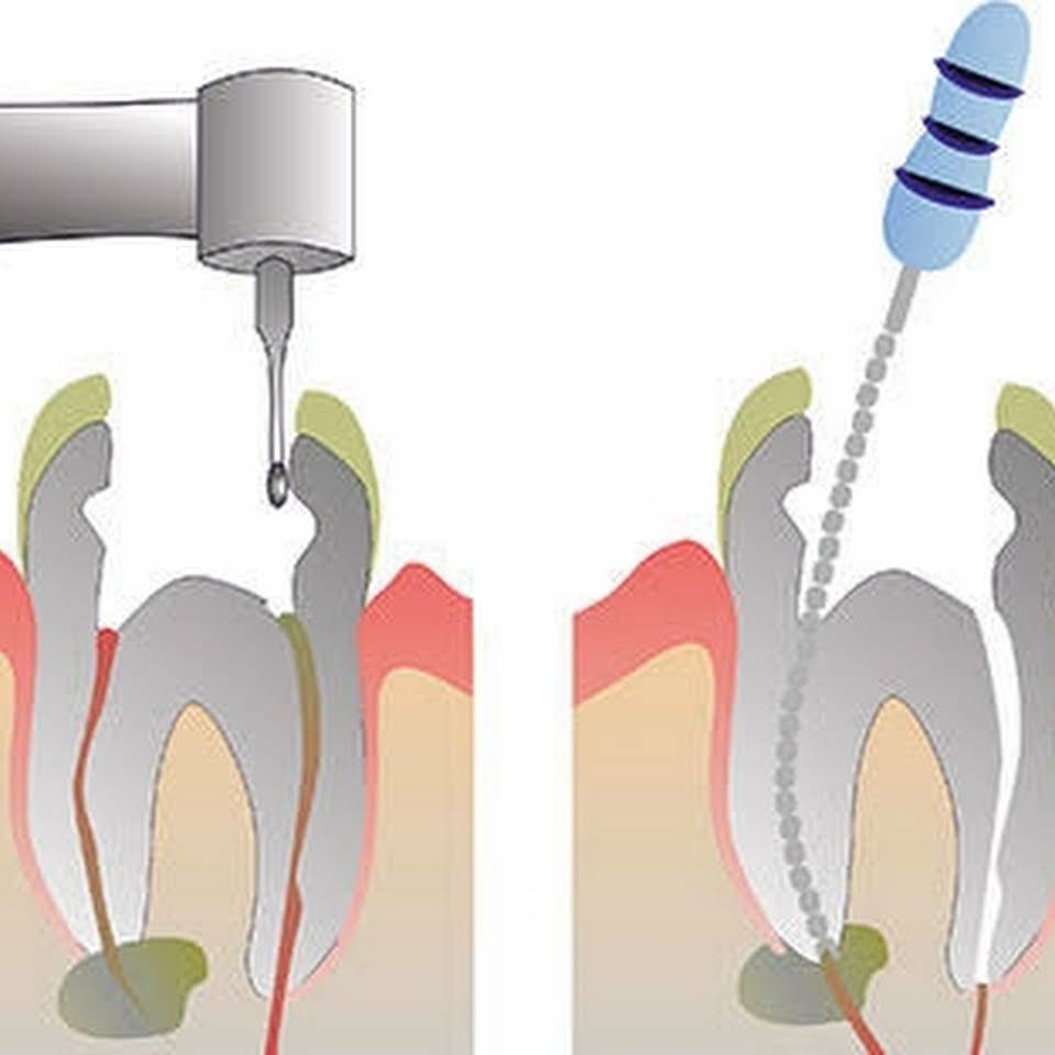 Ujjawal Dental Clinic Medical Services | Dentists