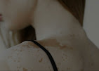 Vitiligo on Back Side Ayurvedic Treatment - Berry Skin Care Medical Services | Clinics